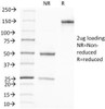 SDS-PAGE Analysis of Purified, BSA-Free PSA Antibody (A67-B/E3) . Confirmation of Integrity and Purity of the Antibody.