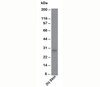 Western blot testing of human samples using 100/D5 antibody.