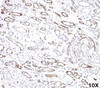 IHC testing of FFPE human kidney transplant tissue (10X) stained with C4d antibody (C4D204) .