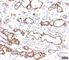 IHC testing of FFPE human kidney transplant tissue (20X) stained with C4d antibody (C4D204) .