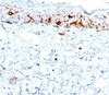 IHC testing of human skin stained with CD1a antibody (C1A/711) .