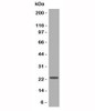 Western blot testing of Jurkat lysate with CD3e antibody.