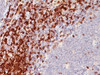 IHC testing of human tonsil stained with CD5 antibody (C5/473)