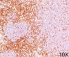 IHC testing of human tonsil stained with CD6 antibody (3F7B5) .