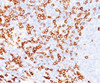 IHC testing of human tonsil (20X) stained with CD8a antibody (C8/468) . Note cell surface staining.