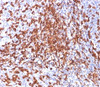 IHC testing of human tonsil stained with HCAM antibody (156-3C11) .