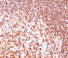 IHC testing of human tonsil with CD74 antibody (LN-2)