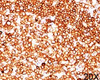 IHC testing of human tonsil (20X) stained with CD79a antibody (JCB117) .