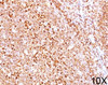 IHC testing of human tonsil (10X) stained with CD79a antibody (HM47/A9) .