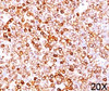 IHC testing of human tonsil (20X) stained with CD79a antibody (HM47/A9) .