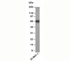 Western blot testing of human samples using Estrogen receptor antibody (ER505) .