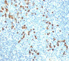 IHC testing of human tonsil stained with anti-IgM antibody (IM260) .