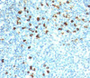 IHC testing of human tonsil stained with Kappa antibody (KLC264) . Note cell membrane & cytoplasmic staining.
