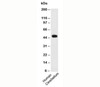 Western blot testing of human samples using PAX6 antibody (PAX6/498) .