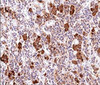 IHC testing of human pituitary gland stained with ACTH antibody (AH26) .