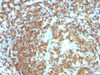 IHC staining of FFPE human tonsil with CD45RA antibody (clone 158-4D3) . HIER: steam section in pH6 citrate buffer for 20 min and allow to cool prior to staining.