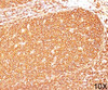 IHC testing of human tonsil (10X) stained with CD45RB antibody (PD7/26) .