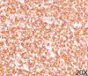 IHC testing of human tonsil (20X) stained with PD7/26 mAb.