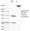 SDS-PAGE Analysis of Purified, BSA-Free RBP Antibody (clone G4E4) . Confirmation of Integrity and Purity of the Antibody.