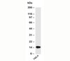 Western blot testing of human samples with SUMO2/3 antibody (SM23/496) .