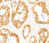 IHC staining of normal colon with p53 antibody (DO-7) .