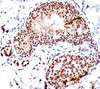 IHC staining of human tonsil with SUMO1 antibody (SM1/495) .