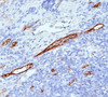 IHC staining of human tonsil with von Willebrand Factor antibody (VWF635) .