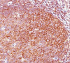 IHC staining of human tonsil with Bcl10 antibody (BL10/411) .