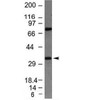 Western blot testing of HepG2 lysate with Bcl10 antibody