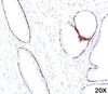 IHC staining of human prostate (20X) with HMW Cytokeratin antibody (34bE12) .