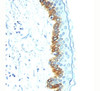 IHC staining of human skin with Acidic Cytokeratin antibody AE1.