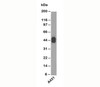 Western blot testing using Acidic Cytokeratin antibody AE1.