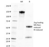 SDS-PAGE Analysis of Purified, BSA-Free CMV Antibody (clone CMV100) . Confirmation of Integrity and Purity of the Antibody.