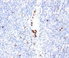 IHC staining of tonsil tissue with Granulocyte Marker antibody (BM-2) . Note specific cytoplasmic staining.