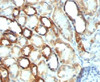 IHC testing of FFPE human renal cell carcinoma with Mitochondria marker antibody