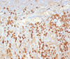 FFPE human tonsil stained with plasma cell marker antibody (LIV3G11) .