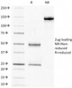 SDS-PAGE Analysis of Purified, BSA-Free HCG-beta Antibody (clone HCGb/211) . Confirmation of Integrity and Purity of the Antibody.