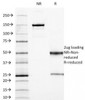SDS-PAGE Analysis of Purified, BSA-Free CEA Antibody (clone C66/1009) . Confirmation of Integrity and Purity of the Antibody.