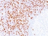 IHC testing of FFPE tonsil tissue with CD8 antibody (clone C8/144B)