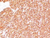 IHC testing of FFPE human tonsil with anti-CD45 antibody