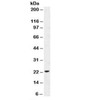 Western blot testing of human MCF7 cell lysate with p21 antibody (clone DCS-60.2) .