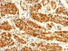 Formalin-fixed, paraffin-embedded human uterus stained with anti-Calponin antibody (CNN1/832) .