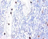 Formalin-fixed, paraffin-embedded human tonsil stained with G-CSF antibody (CSF3/900) . Note specific cytoplasmic staining of granulocytes.