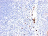 Formalin-fixed, paraffin-embedded human tonsil stained with GCSF antibody (SPM468) .