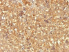 Formalin-fixed, paraffin-embedded human fetal liver stained with AFP antibody (MBS-12) .