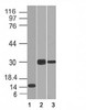 Western blot of 1) partial recombinant protein, 2) Panc-28 and 3) PANC1 cell lysate using CELA3B antibody (CELA3B/1218) . Predicted molecular weight ~29 kDa.