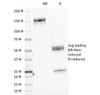 SDS-PAGE Analysis of Purified, BSA-Free CELA3B Antibody (clone CELA3B/1218) . Confirmation of Integrity and Purity of the Antibody.