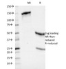 SDS-PAGE Analysis of Purified, BSA-Free HLA-ABC Antibody (clone 246-B8.E7) . Confirmation of Integrity and Purity of the Antibody.