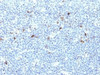Formalin-fixed, paraffin-embedded human tonsil stained with HLA-Aw32 / HLA-A25 antibody (CATA-1) .