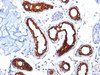 Formalin-fixed, paraffin-embedded human skin stained with Cytokeratin 18 antibody (KRT18/834) .